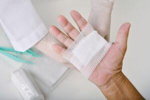 A man with a dog bite injury on his hand, wondering about the states with one-bite rules and mixed dog statutes.