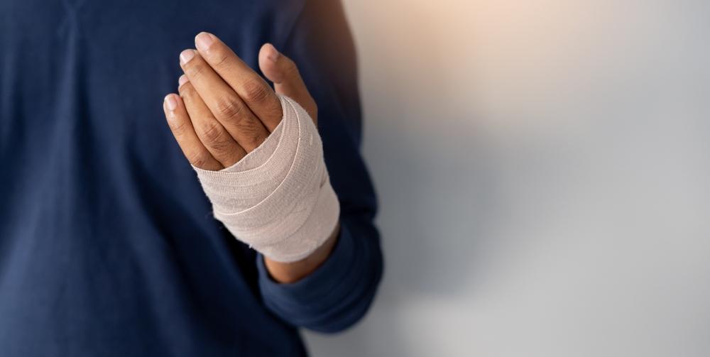 A man with his hand bandaged from a dog bite, wondering what the dog bite laws in Washington are.